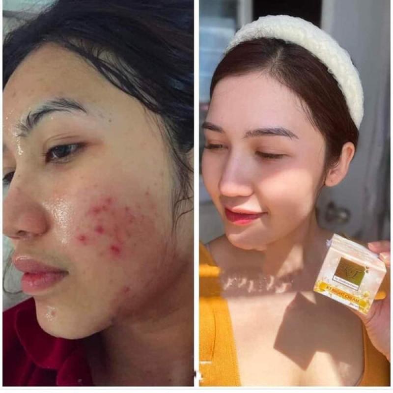 KT Pearl Night Cream 10gm