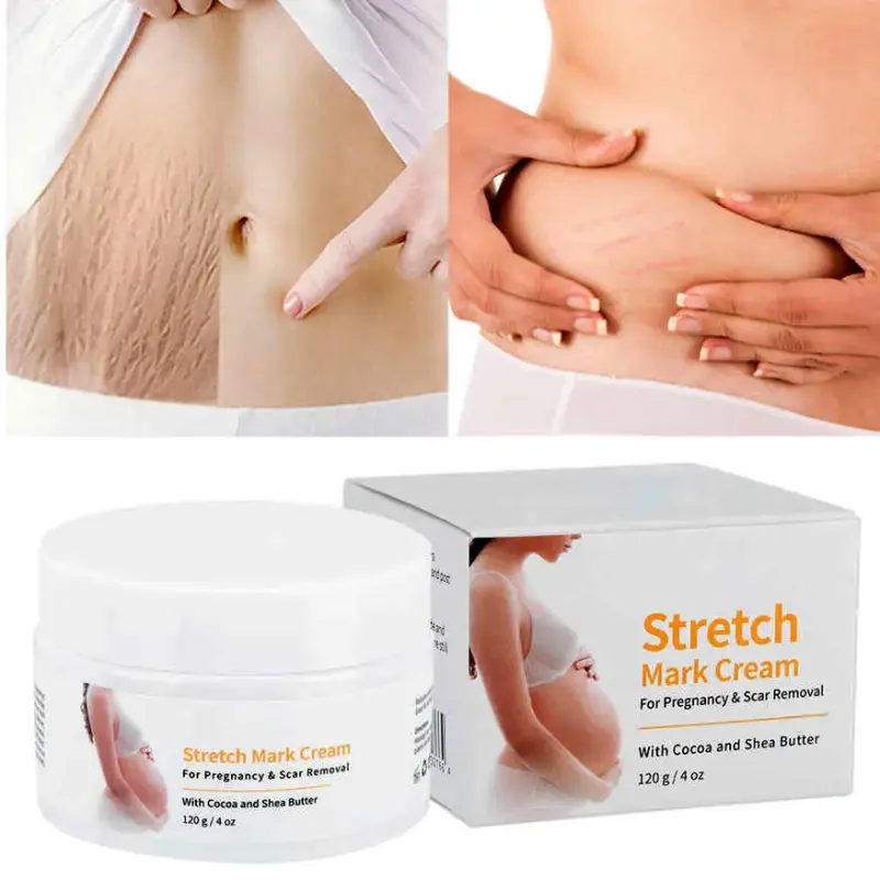 MELAO Stretch Mark Cream – For Pregnancy & Scar Removal